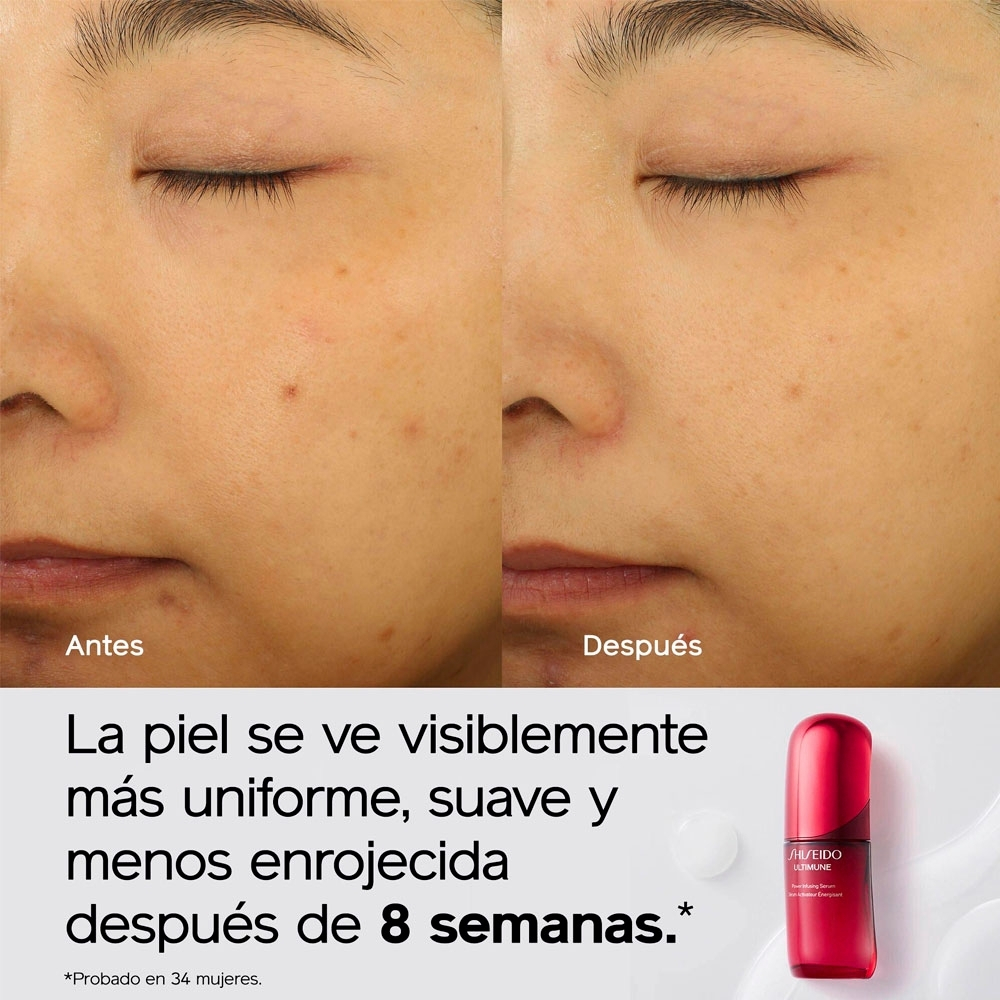 ULTIMUNE POWER INFUSING SERUM (S&Eacute;RUM ANTI- EDAD)